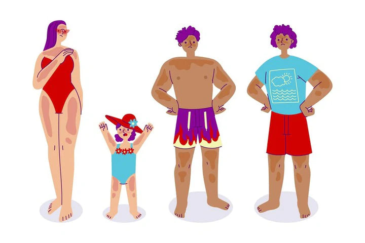 Top 10 Swimwear Trends for 2024: Styles for Men, Women, and Kids